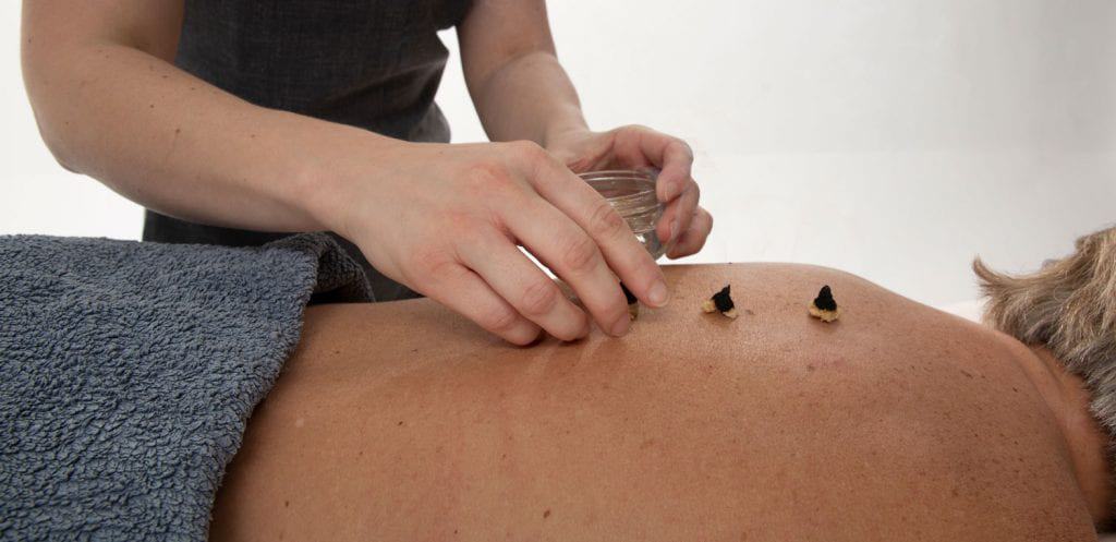 Acupuncture-Bournemouth-Poole-Christchurch-Cupping-Gua-Sha-Auricular-Moxibustion-Facial-Revitalisation-Rejuvenation-cosmetic-best